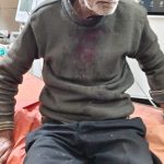 मल्लीताल में तेज रफ्तार वाहन ने बुजुर्ग को मारी टक्कर, घायल बुजुर्ग के सर में आई  गम्भीर चोट,वाहन चालक वाहन समेत फरार,